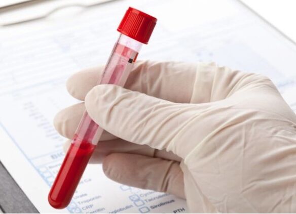 Metodele de diagnostic de laborator vă permit să identificați microflora sau virusul patologic