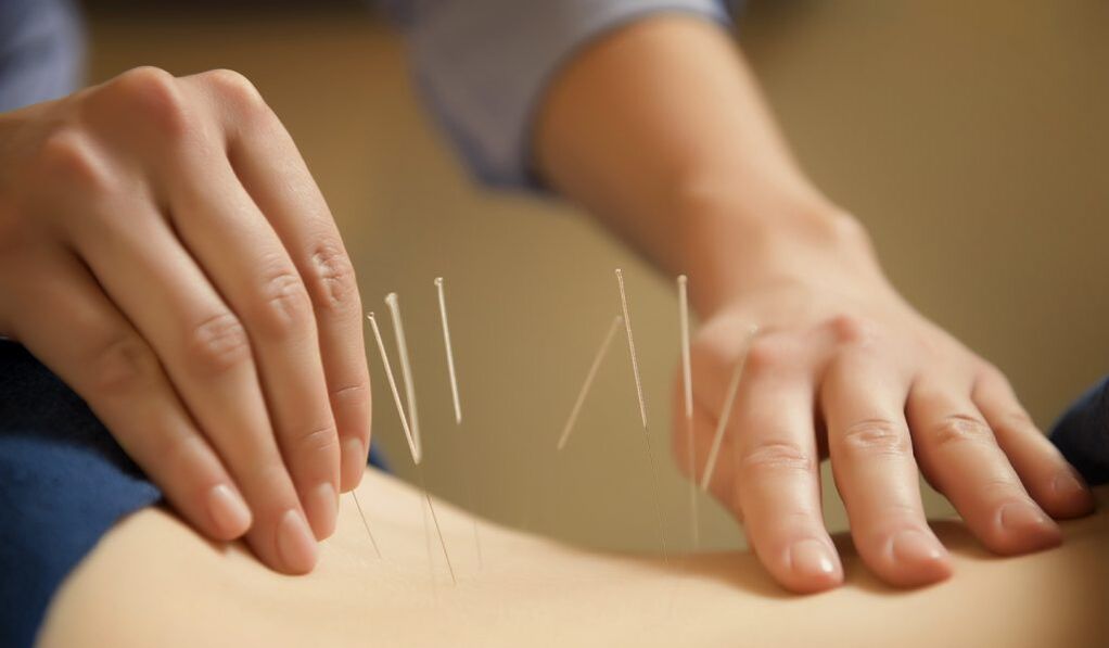 Acupunctura este o metodă comună de tratare a prostatitei cronice